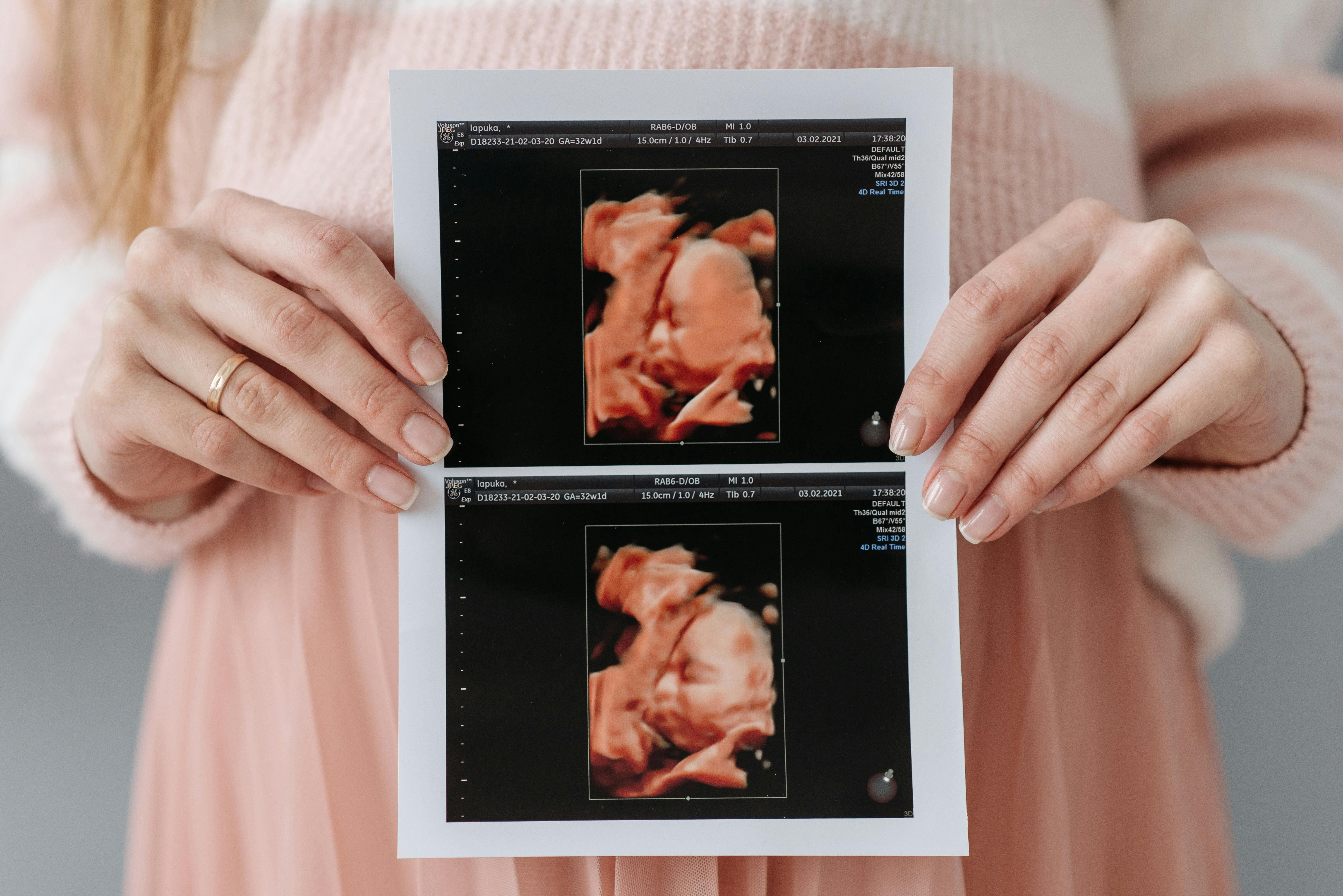 First trimester